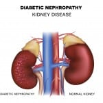 From the latest medical news articles: heartburn drugs linked to kidney damage