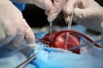 HIV Organ Transplant: historical first!