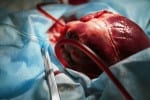 Should the rest of the UK join Wales in an opt-out organ donor system?