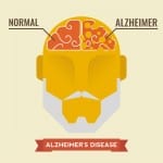 What happens to the brain when Alzheimer's takes effect