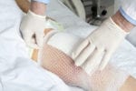 Medical news wound healing